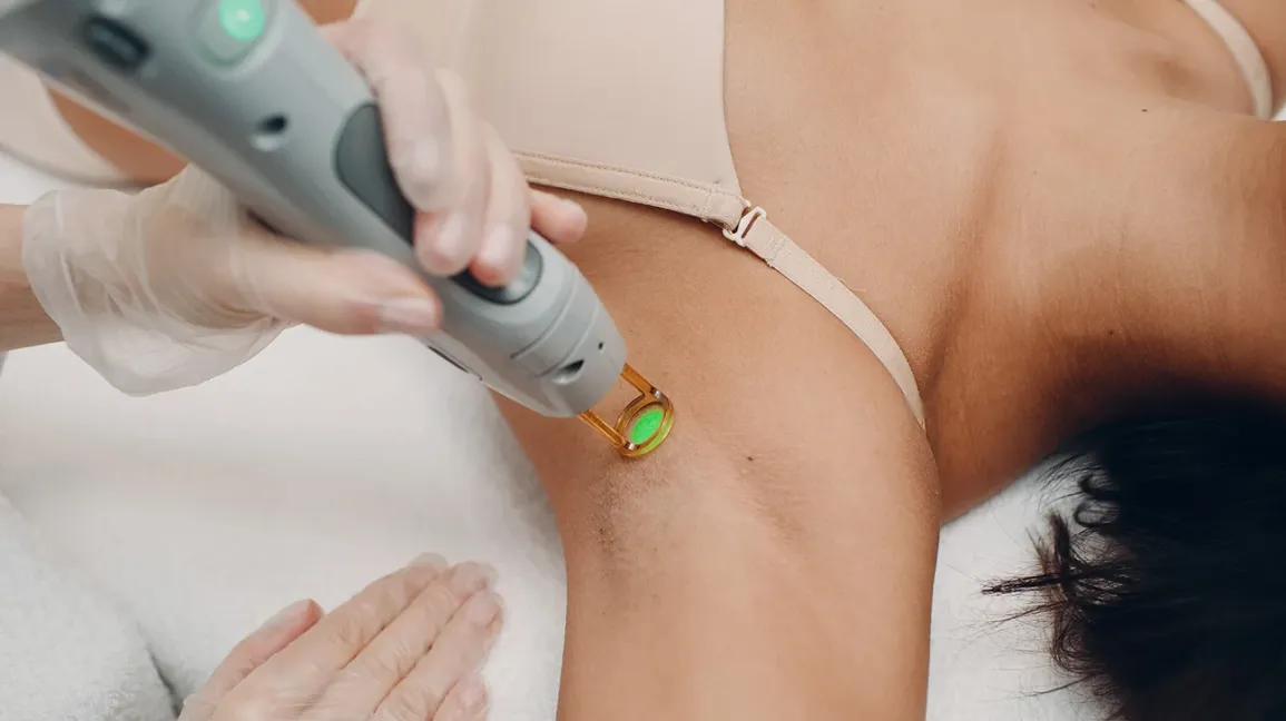 Sleek Solutions: Underarms Laser Hair Removal
